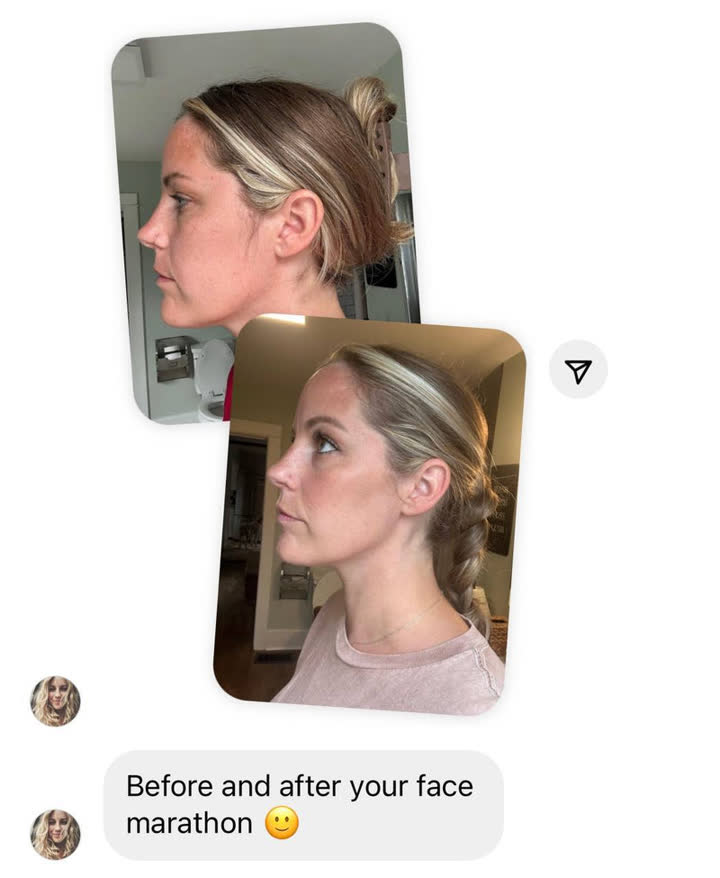 Client result 9 of 16: before and after photos and a message to Karina
