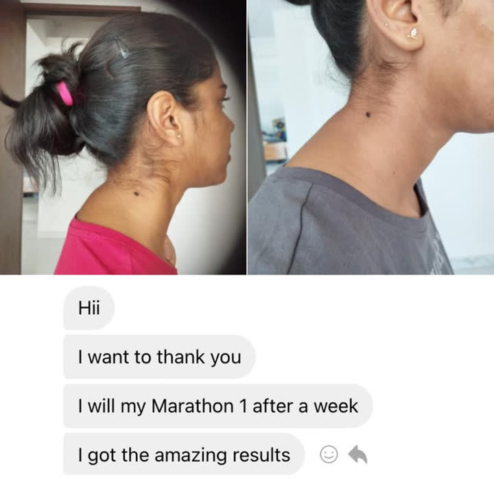 Client result 13 of 16: before and after photos and a message to Karina