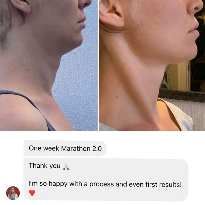 Client result 15 of 16: before and after photos and a message to Karina